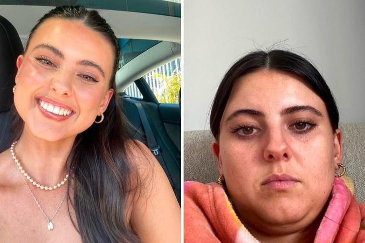 Instagram vs. valóság: egy influenszer saját testén keresztül hívja fel a figyelmet arra, mennyire félrevezető lehet a közösségi média. Az ideális képek mögött rejlő valóságot mutatja be, ezzel bátorítva követőit, hogy fogadják el önmagukat és ne hasonlít